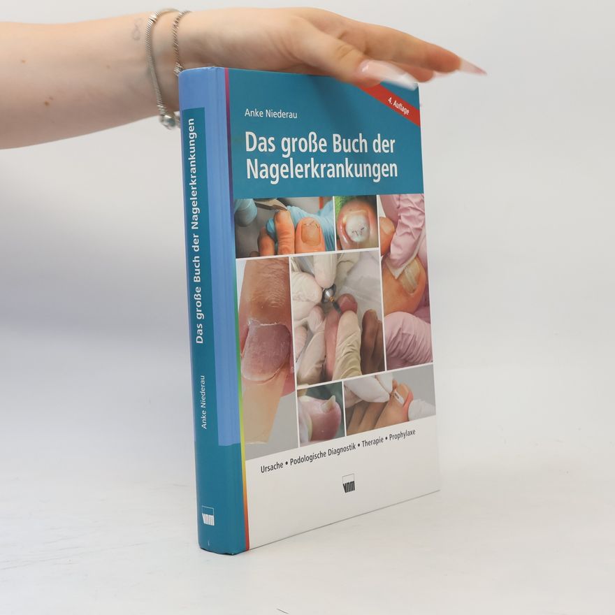 Anke Niederau Das große Buch der Nagelerkrankungen