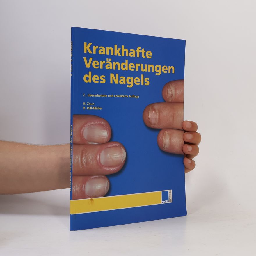 Dorothee Dill-Müller Krankhafte Veränderungen des Nagels