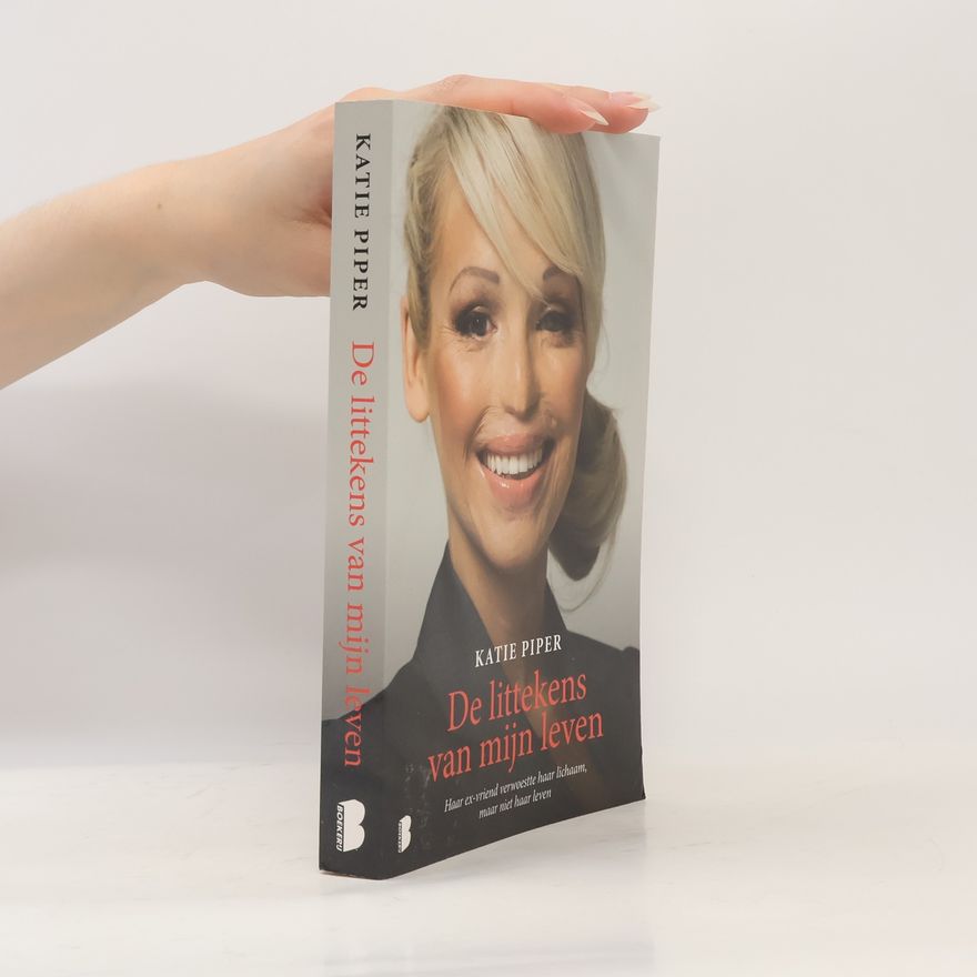 Katie Piper De littekens van mijn leven