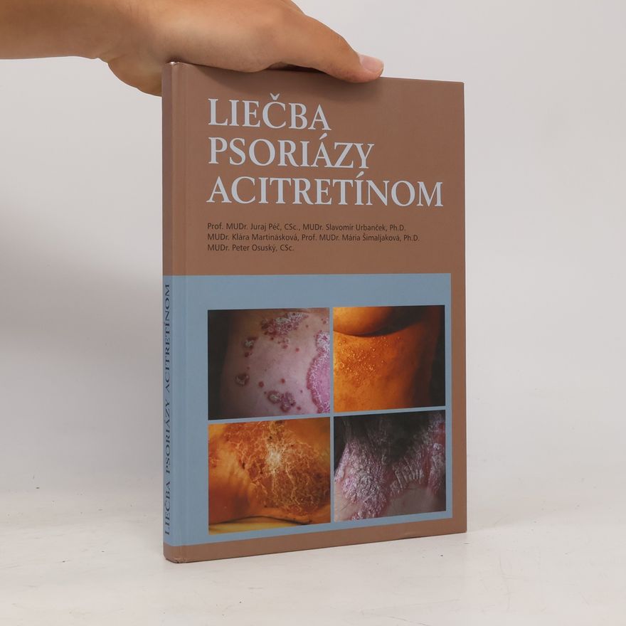 Juraj Péč Liečba psoriázy acitretínom