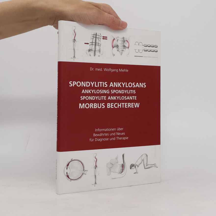 Wolfgang Miehle Spondylitis ankylosans - Morbus Bechterew