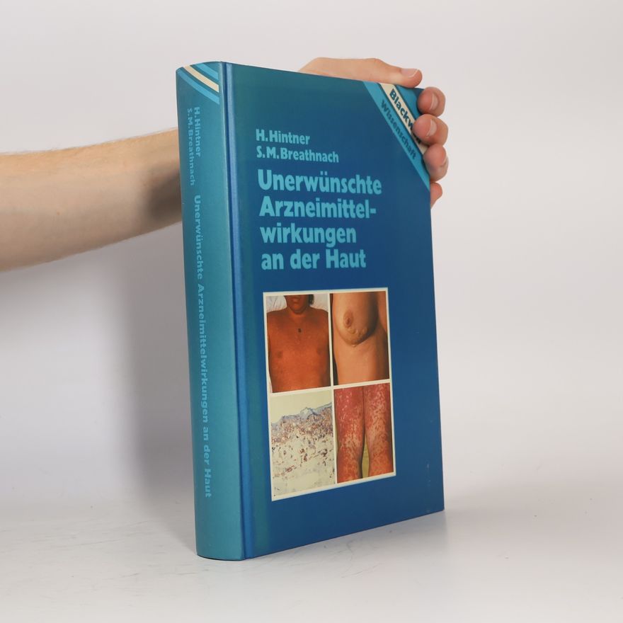 Stephen M. Breathnach Unerwünschte Arzneimittelwirkungen an der Haut