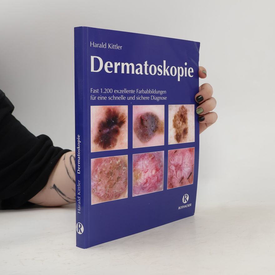 Harald Kittler Dermatoskopie