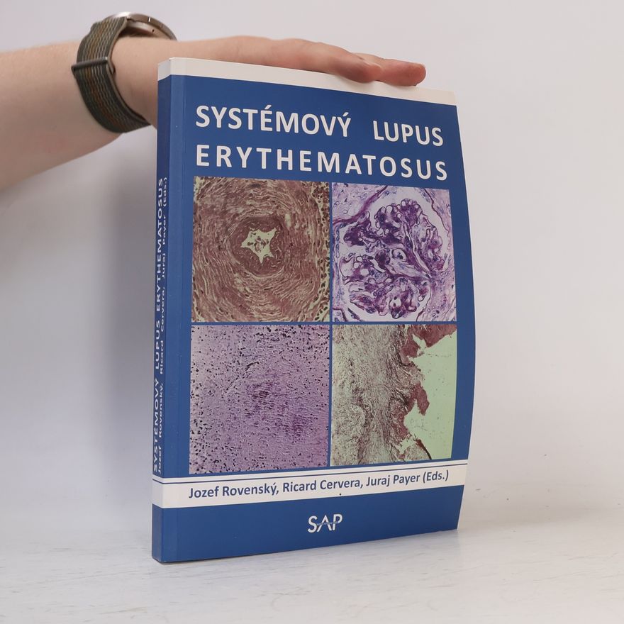 Ricard Cervera Systémový lupus erythematosus