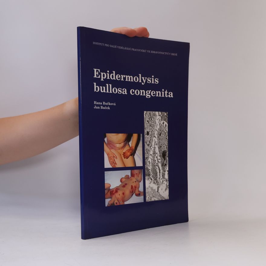 Hana Bučková Epidermolysis Bullosa Congenita