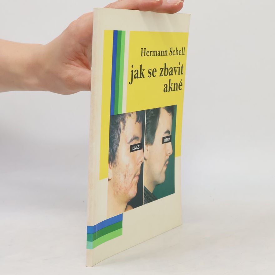 Hermann Schell Jak se zbavit akné