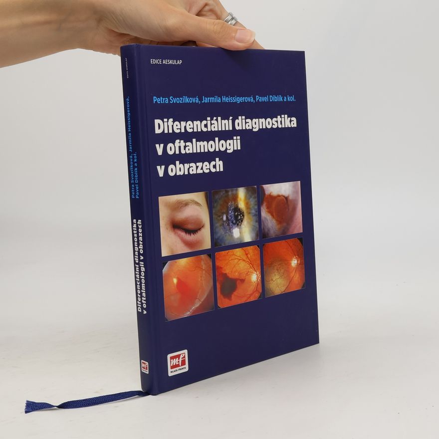 Petra Svozílková Diferenciální diagnostika v oftalmologii v obrazech