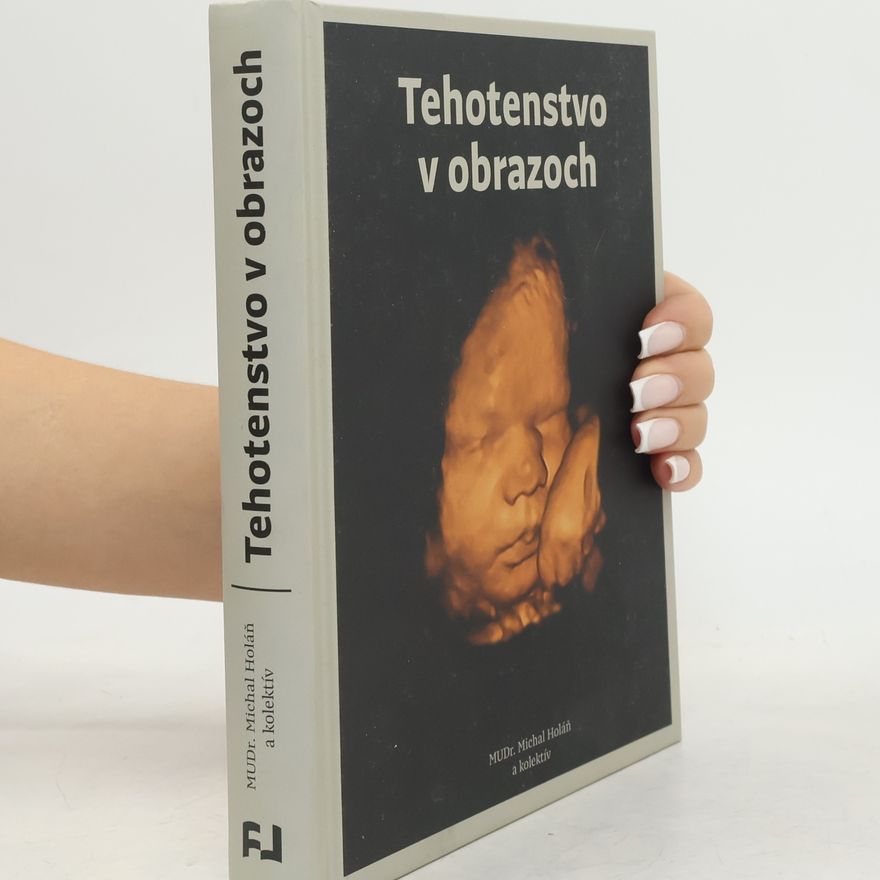 Autorenkollektiv Tehotenstvo v obrazoch