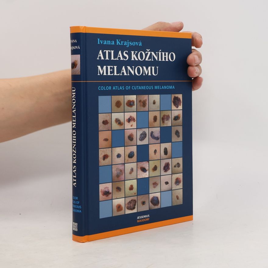 Ivana Krajsová Atlas kožního melanomu