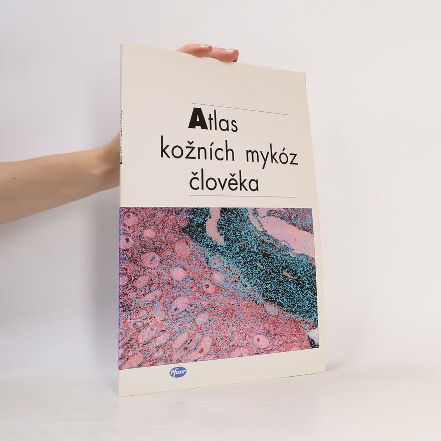 Kolektiv autorů Atlas kožních mykóz člověka