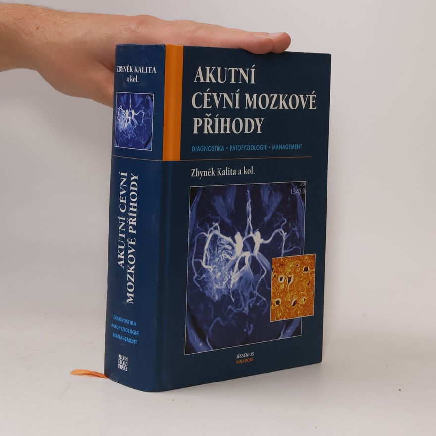 Zbyněk Kalita Akutní cévní mozkové příhody . diagnostika, patofyziologie, management