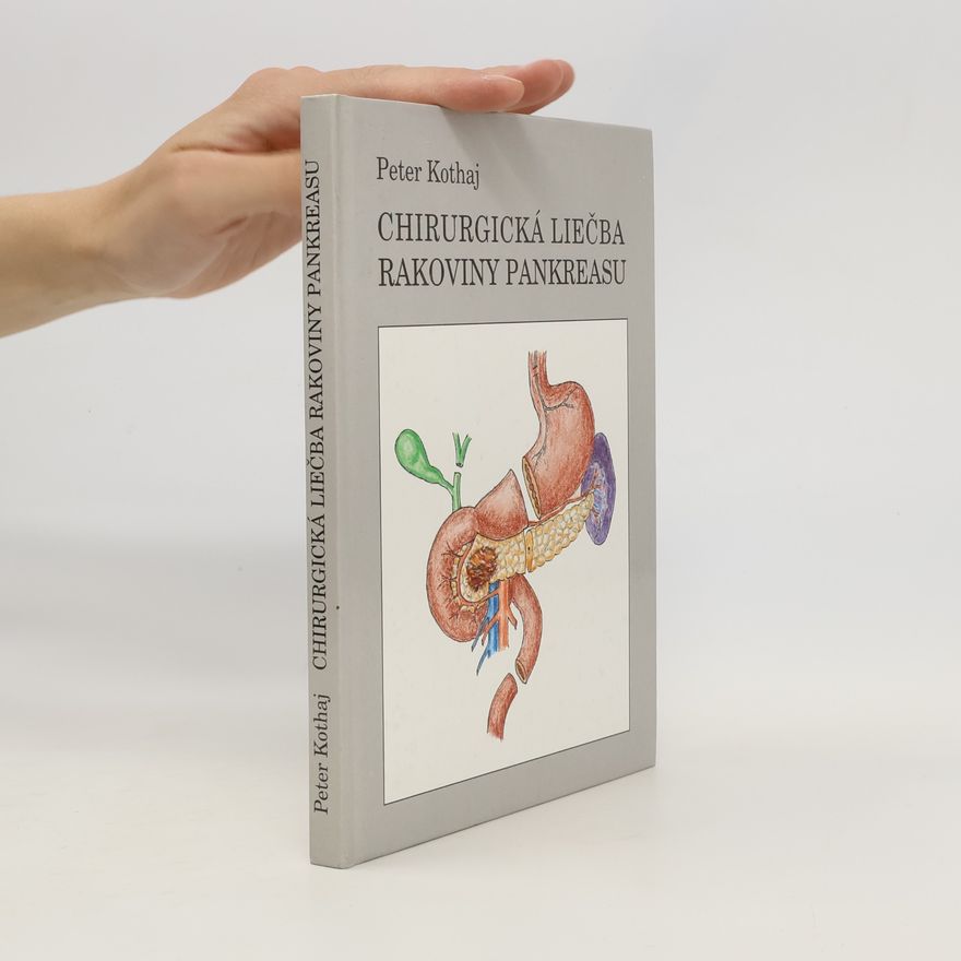 Peter Kothaj Chirurgická liečba rakoviny pankreasu