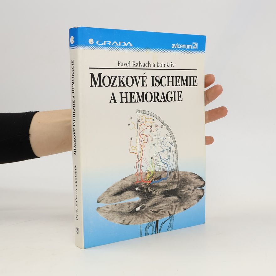 Pavel Kalvach Mozkové ischemie a hemoragie