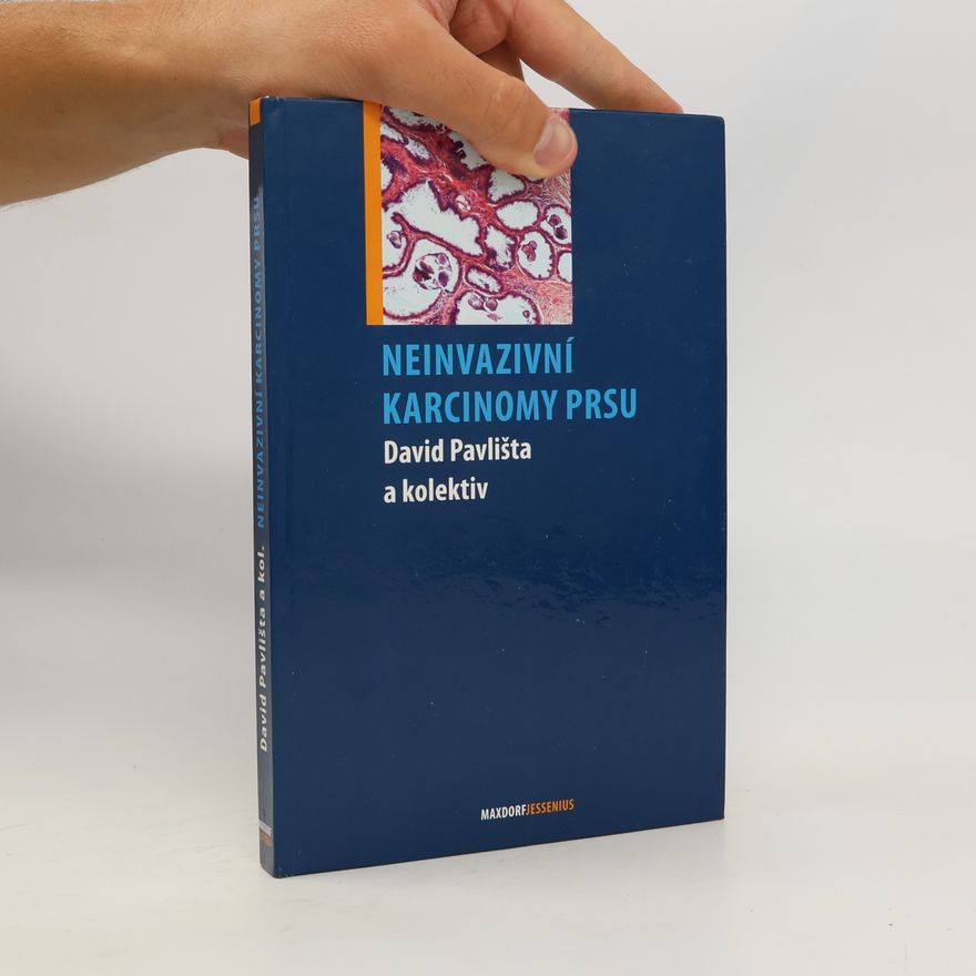 David Pavlišta Neinvazivní karcinomy prsu
