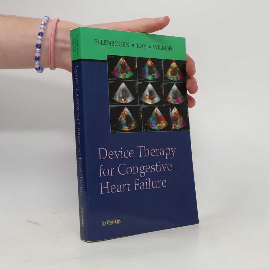 G. Neal Kay Device Therapy for Congestive Heart Failure