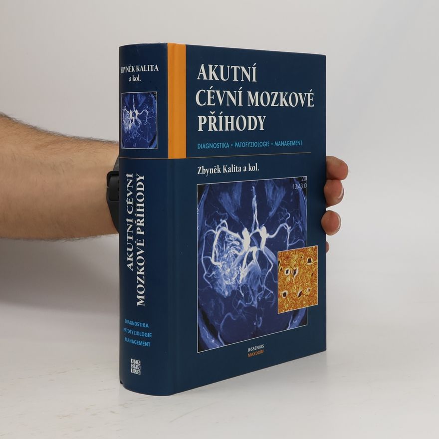 Zbyněk Kalita Akutní cévní mozkové příhody . diagnostika, patofyziologie, management