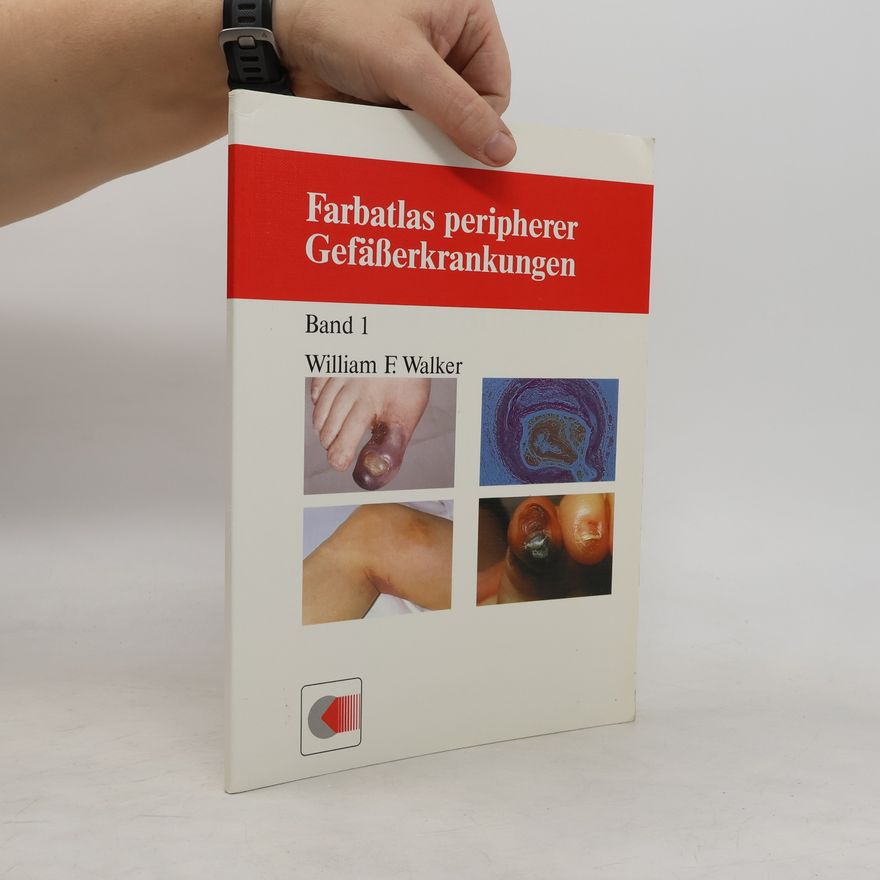 William F. Walker Farbatlas peripherer Gefäßerkrankungen