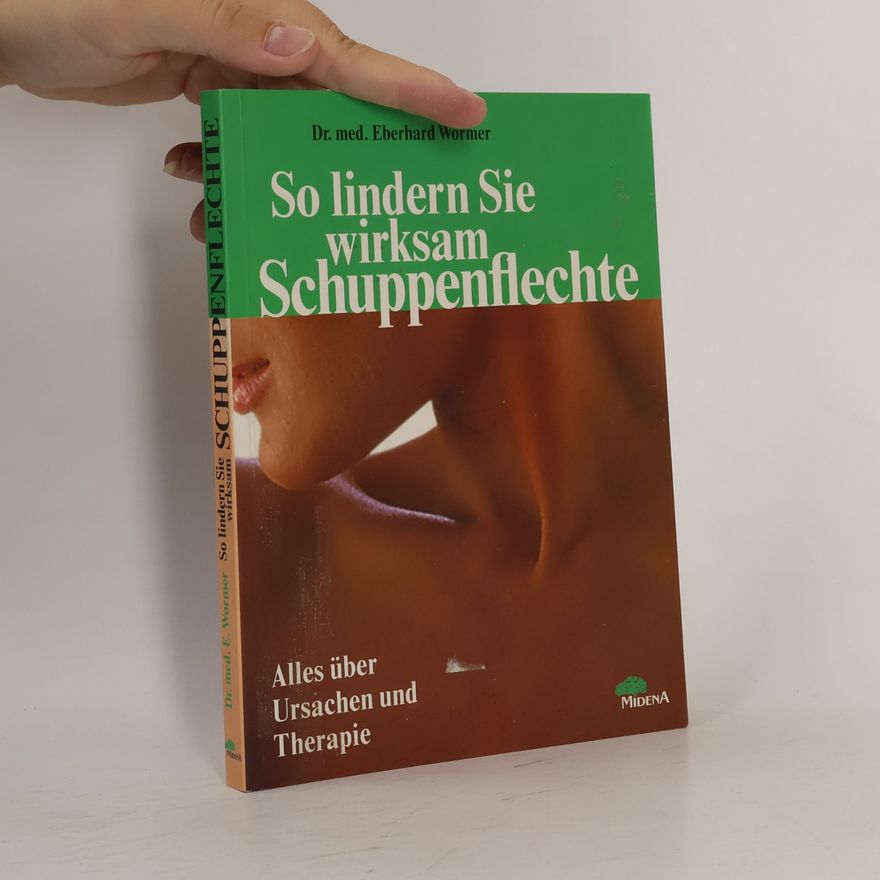 Eberhard J. Wormer So lindern Sie wirksam Schuppenflechte