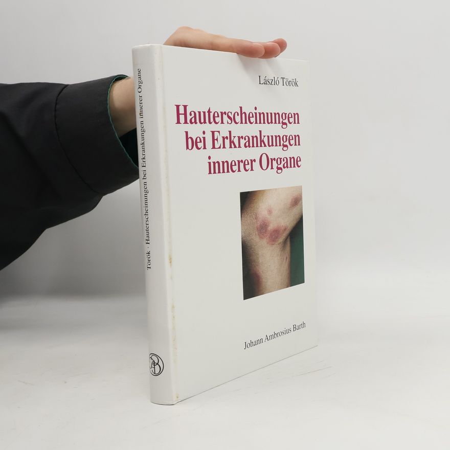László Török Hauterscheinungen bei Erkrankungen innerer Organe