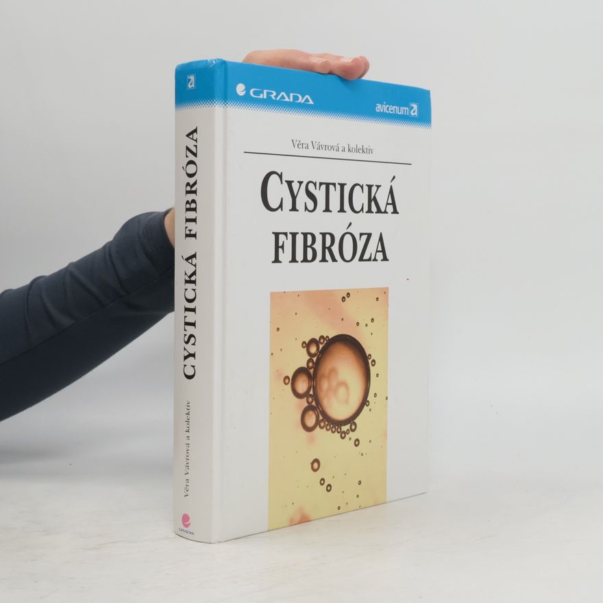 Věra Vávrová Cystická fibróza