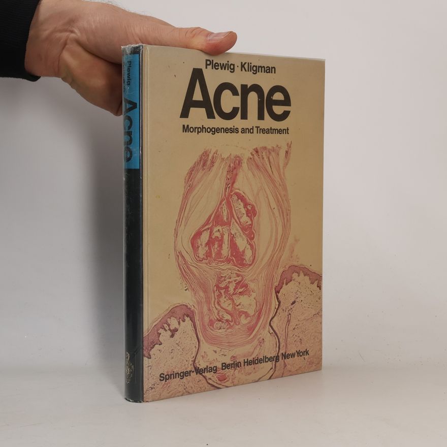 A.M. Kligman Acne