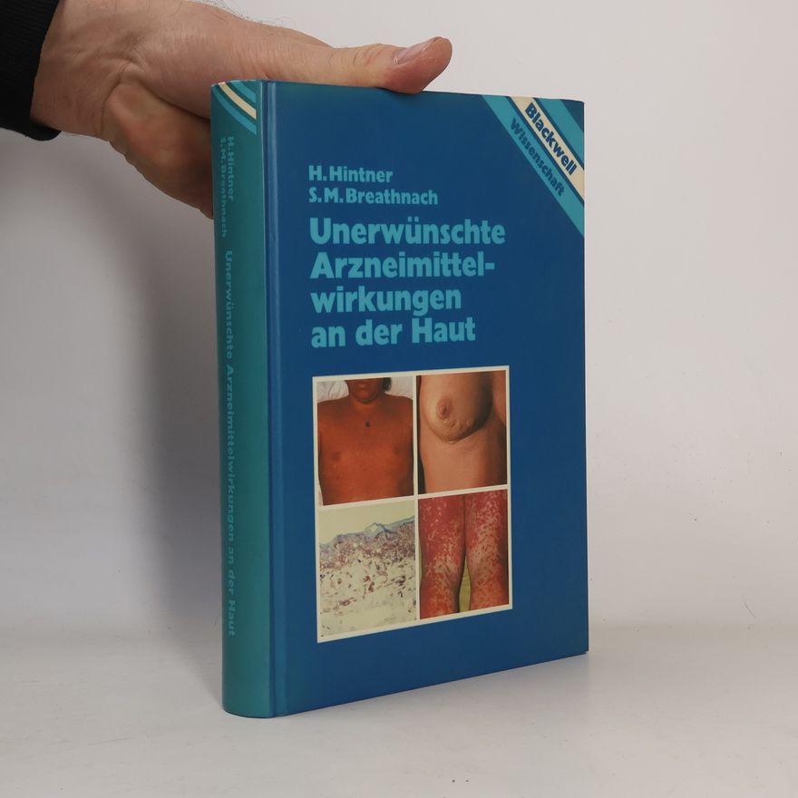 Stephen M. Breathnach Unerwünschte Arzneimittelwirkungen an der Haut