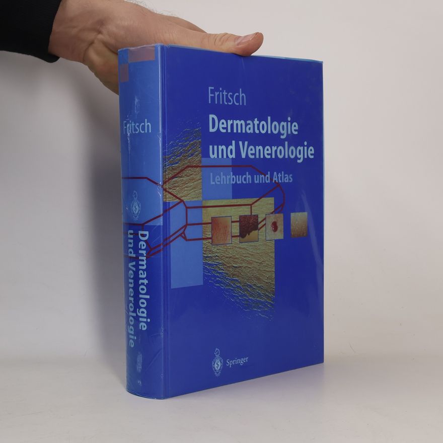 Peter Fritsch Springer-Lehrbuch: Dermatologie und Venerologie