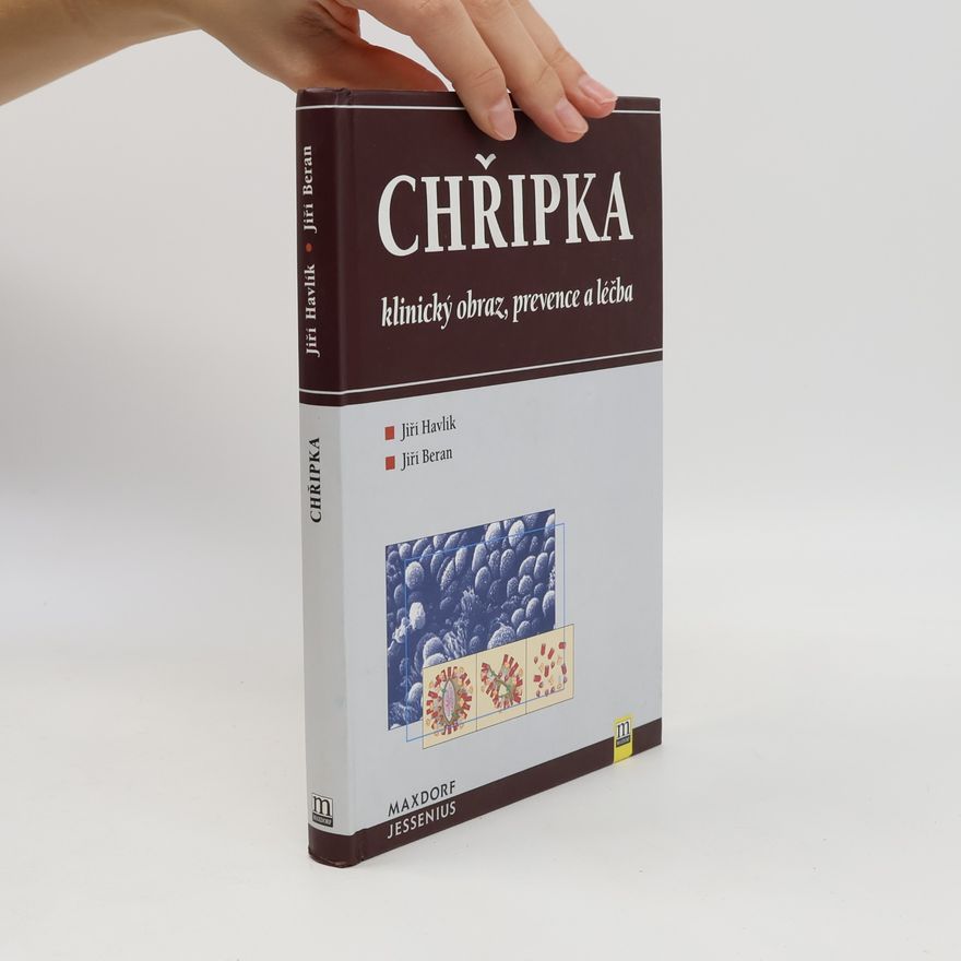 Jiří Beran Chřipka - klinický obraz, prevence a léčba