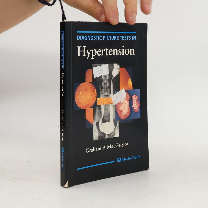 Graham A. MacGregor Diagnostic Picture Tests in Hypertension